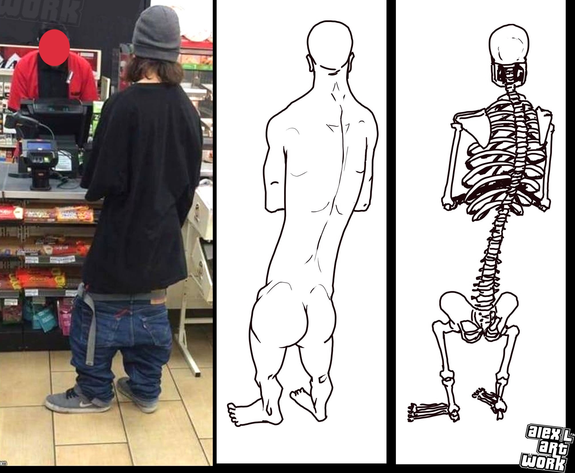 Sagging jeans visual example for keypoint detection failure